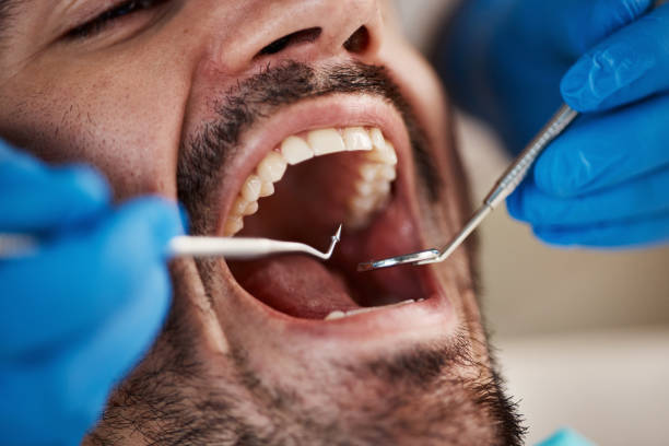 Best Dental Fillings (Composite and Amalgam)  in Fairborn, OH